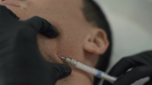 Detailní Záběr Injekční Stříkačka Jehlou Pod Kůži Mužů Zpřísnění Procedury — Stock video
