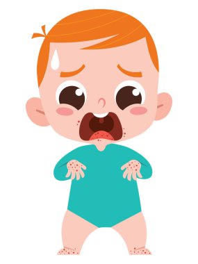 Deri döküntüsüyle Ağlayan Bebek. El Ayak Ağzı Hastalığı