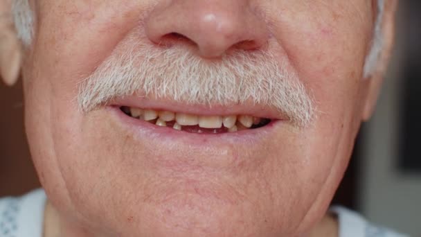老年男子无牙笑嘴特写宏观镜头 牙齿问题 严重的牙齿脱落 养恤金领取者祖父 牙齿腐烂 牙釉质衰弱 牙齿脱落 — 图库视频影像