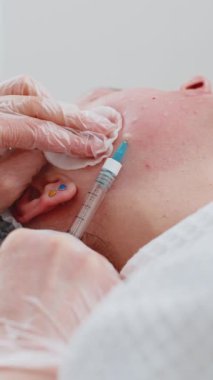 Güzellik yaşlanmayı önleyici enjeksiyonlar biyo-evitalizasyon, yanak mezoterapisi ile karşılaşıyor. Kozmetik doktoru genç bir kızın derisine iğne kolajen enjeksiyonu yapıyor. Klinikte prosedür terapisi