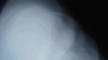 Işık sızıntısı 4K görüntüsü. Lens parlaklığı bokeh örtüleri, yanan alev arka planı. Görüntülerinizi birleştirmek, videoyu biçimlendirmek, dönüşümleri sağlamak için. Odaklanmış lamba flaş ışını etkisi. Işık titreşimleri ve ışıltı