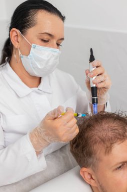 Alopecia. Erkek saçı kaybı büyüme tedavisini, dermapen mikronedling 'i, vitamin egzomları plazma serumu enjeksiyonlarını iyileştirir. Trichologist doktor kafa derisi prosedürü Kısmi mezoterapi
