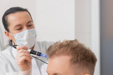 Alopecia. İnsan saçı kaybı büyüme tedavisini, dermapen mikronedling 'i, vitamin egzomları plazma serumu enjeksiyonlarını iyileştirir. Trikoloğun kozmetik doktoru kafa derisi yüzme prosedürü mezoterapisi.