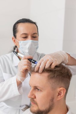 Alopecia kelleşmesi. İnsan saçı kaybı büyüme tedavisini, dermapen mikronedling 'i, vitamin egzomları plazma serumu enjeksiyonlarını iyileştirir. Trichologist doktor kafa derisi prosedürü Kısmi mezoterapi
