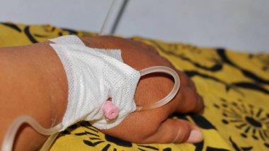 Yakından birinin eline serum takılıyor. Sağlık ve Tıbbi Ekipman Konsepti