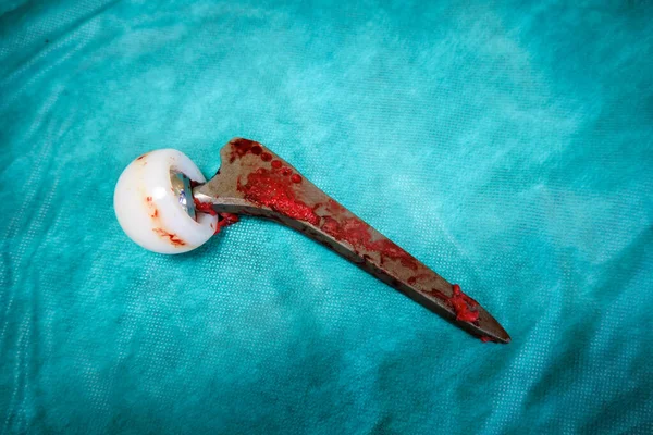 Ameliyat masasında eski bir izah edilmiş kalça protezi yatıyor.