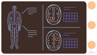 Diagram of human anatomy showing nervous system and two brain scans with highlighted sections and notes. Ideal for neurology, healthcare, education, diagnostics, research, anatomy study, simple flat