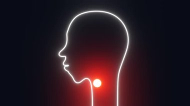 Sore throat concept. Human head silhouette with red glowing acute nasopharynx pain 3d animation 4K. Tonsillitis illness Patient with painful swallowing, malaise, inflammation, fever virus symptoms.