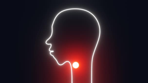 Sore Throat Concept Human Head Silhouette Red Glowing Acute Nasopharynx — Stockvideo