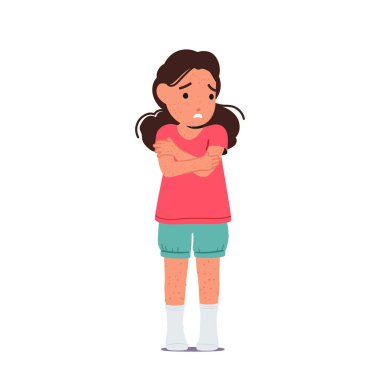 Maymun Çiçeği virüsü belirtileri gösteren küçük bir kız karakteri. Çocuk Sağlığı Hizmetleri Hastalık Yayılma ve Önlem Enfeksiyonuna karşı Uyarı. Çizgi film İnsanları Vektör İllüstrasyonu