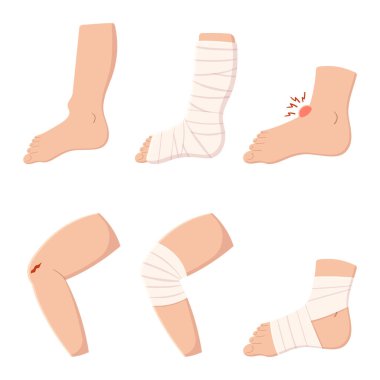 Beyaz arka planda kan ve bandajla izole edilmiş bacak, ayak ve diz yaralanması. İlk yardım, yara, sağlık, uzuv travması, kırık tedavisi ya da rehabilitasyon konsepti. Çizgi film Vektör İllüstrasyonu