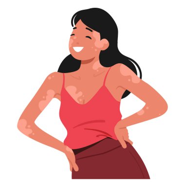 Neşeli kadın eşsiz güzelliğini Vitiligo ile kucaklıyor, kendine güven ve kendini beğenmişlik yayıyor. Gülümsemesi, direnci yansıtıyor, çeşitliliği kutluyor, pozitifliği ve kabulü teşvik ediyor. Vektör İllüstrasyonu