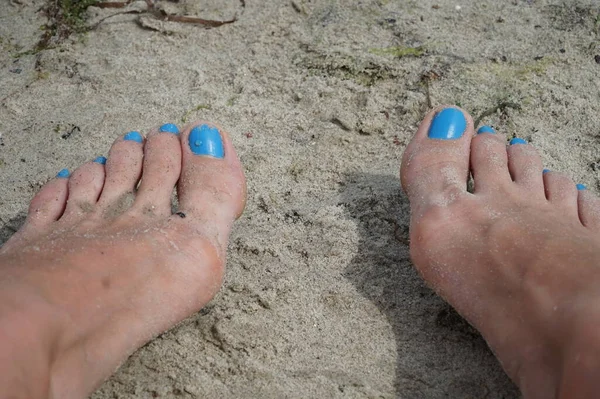 Women\'s feet on the sand. The girl develops hallux valgus on her foot