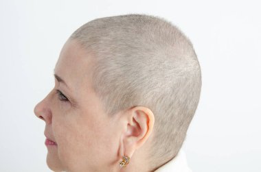 Bu yan profil çekiminde kemoterapiden 70 gün sonra saçlarının uzamasını gösteren bir kadın iyileşme sürecini ve vücudunun esnekliğini simgeliyor..