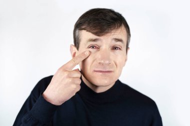 Arka planda bir adam acı çekiyor, ekranda sürekli çalışmaktan yorgun ve kırmızı gözlü bir adam - bilgisayar, dizüstü bilgisayar, akıllı telefon. Adamın konjonktivit ve kırmızı gözleri var. Tıbbi konsept