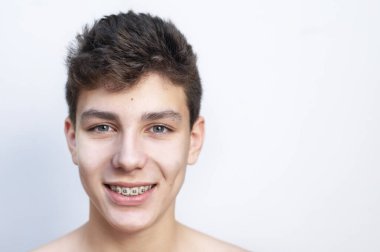 Dişlerini düzenlemek için diş telleriyle arka planda gerçekten gülümseyen yakışıklı bir gencin portresi. Uzayı kopyala Diş Konsepti