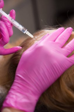 Beautician in a beauty salon makes injections in the head with a syringe. Mesotherapy for hair growth.
