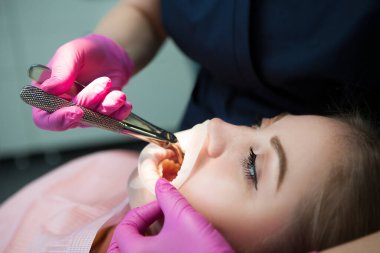 Doktor dişçi, hastanede bir hastaya diş çıkarıyor. Tek kullanımlık lastik ağız açacağı..