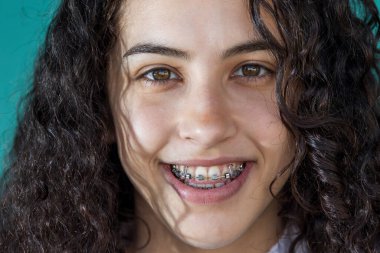 Kıvırcık saçlı, gülümseyen ve dişlerinde metal diş telleri olan güzel bir kızın portresi.