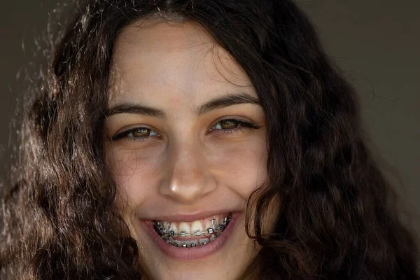 Retrato Chica Bonita Con Pelo Rizado Sonriendo Mostrando Tirantes Metal — Foto de Stock