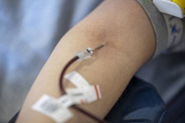 Klinikte iğne kullanılarak erkek donörün kolundan kan alınıyor.