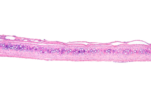 Kemik Hücreleri Bölüm 20X Işık Mikrografı Osteonlu Haversian Sistemli Kanallı — Stok fotoğraf
