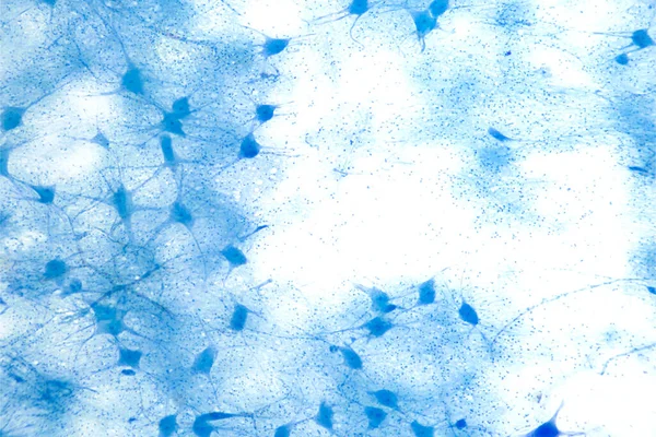 Motor neuron cells, whole mount, 8X light micrograph. Motoneurons under a light microscope. Motor neurous cells, also called efferent neurons, with axons, nerve fibers, that carry electrical signals.