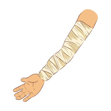 Düz dizaynlı sargılı el. Bandaj pansuman ile insan kolu kırılmış. Vektör çizimi izole edildi.