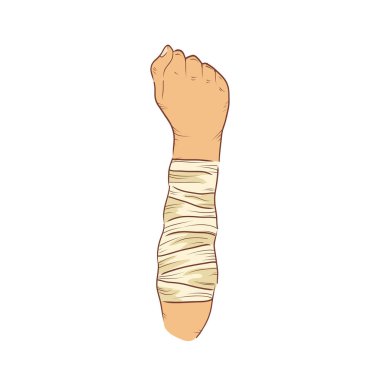 Düz dizaynlı sargılı kol. Yaralı uzuvları bandajlı. Vektör çizimi izole edildi.