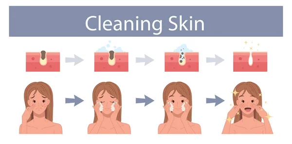 面部皮肤护理 毛孔清洁概念 脸上塞满了清洁阶段的女人 清洁皮肤的步骤 矢量卡通画 — 图库矢量图片