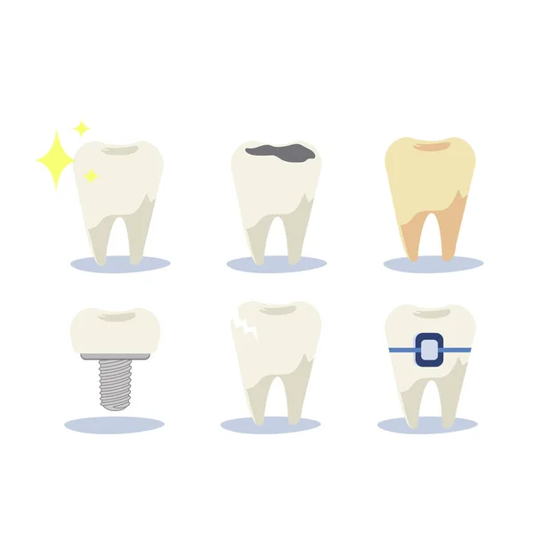 Концепція Стоматологічного Здоров Набір Зубів Різними Видами Стоматологічних Захворювань Імплантація — стоковий вектор