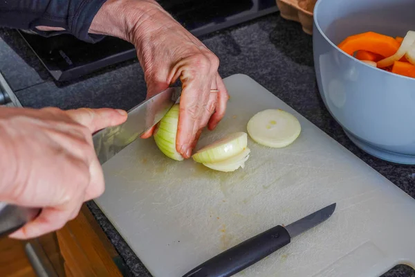 Woman Slices Onion Kitchen — Stock Photo, Image