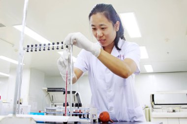 Luannan - 29 Haziran 2015: Laboratuvar teknisyenleri 29 Haziran 2015 'te hastanede kan örneklerini test etti.