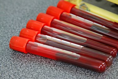 Test tüpündeki serum örnekleri, fotoğrafa yakın çekim.
