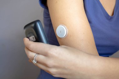 Female hand with continuous glucose monitor doing reading from the arm patch clipart