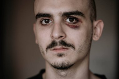 Injured young man with bruises on his face