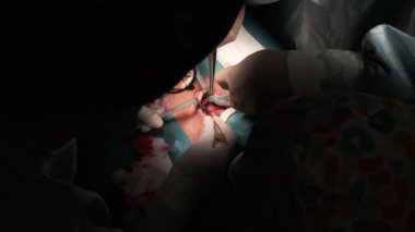 Meçhul cerrahların tiroit bezi temizleme ameliyatını ameliyathanede yaptıkları en iyi görüntü.