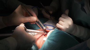 Kimliği belirsiz cerrahların tiroid bezi çıkarma ameliyatından tanınmayan bir hastaya ameliyathanede.