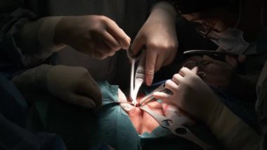 Tiroid bezi ameliyatı için modern aletleri olan isimsiz cerrahlar ameliyathanede ameliyat yapacaklar.
