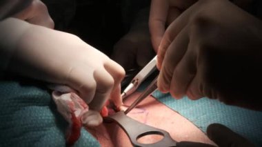 Tiroid bezi ameliyatı için modern aletleri olan isimsiz cerrahlar ameliyathanede ameliyat yapacaklar.