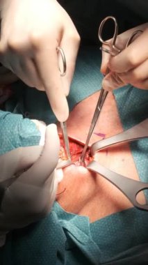 Kimliği belirsiz cerrahların tiroid bezi çıkarma ameliyatından tanınmayan bir hastaya ameliyathanede.