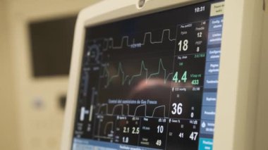 Ekrandaki grafik çizgileri kalp EKG 'sini gösteriyor. Hastanedeki ameliyat sırasında hastaların durumu hakkında.