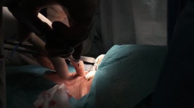 Tiroid bezi ameliyatı yaparken özel aletler kullanan isimsiz cerrahlar ameliyathanede ameliyata alınır.