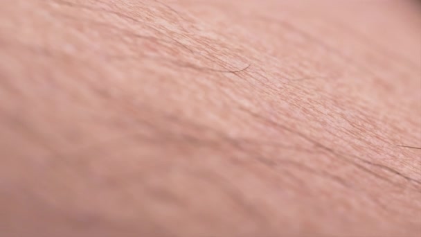 Detailní Záběr Lidskou Kůži Vlasy Makro Záběry Ukazující Kůži Vlasy — Stock video