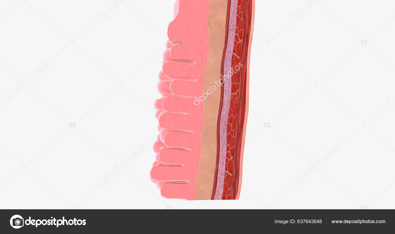 Adenocarcinoma Esophagus Results Abnormal Cell Mutations Growth ...