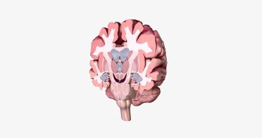 Alzheimer's Disease Brain Cross Section 3D rendering