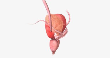 The Bladder Cancer, Stage III 3D rendering