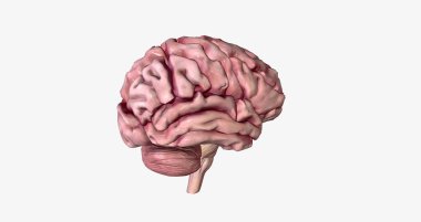 Brain with Severe Alzheimer's Disease 3D rendering