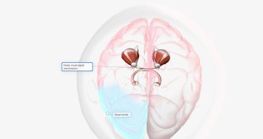 Strabismic Amblyopia, Visual Pathway with Eye Movement 3D rendering