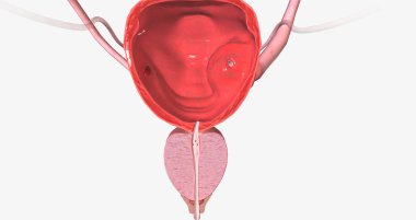 A ureterocele is a congenital defect of the ureter, the tube that carries urine from the kidney to the urinary bladder. 3D rendering